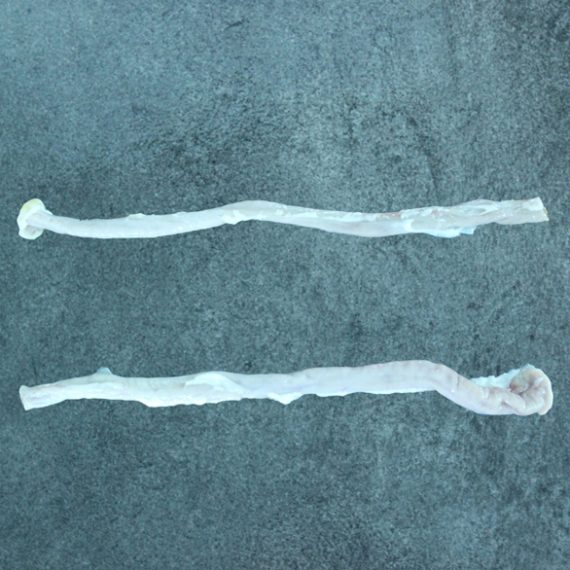 Frozen Duodenum Frozen Duodenum